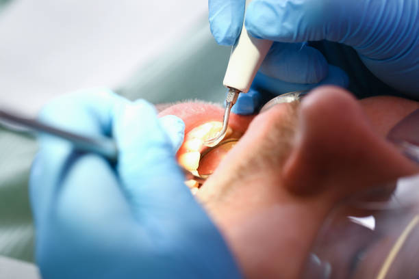 Best Walk-In Emergency Dentist in Eastern Goleta Valley, CA