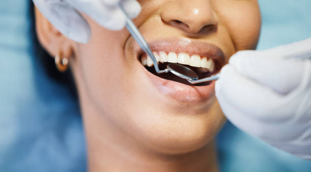 Best Emergency Dental Care for Trauma or Injury in Eastern Goleta Valley, CA