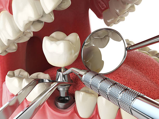 Best Weekend Emergency Dentist in Eastern Goleta Valley, CA